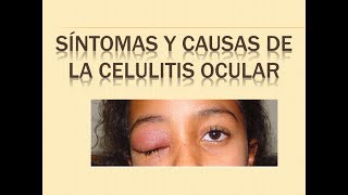 CELULITIS OCULAR  SINTOMAS Y CAUSAS [upl. by Aicirtal]