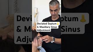 Deviated Septum amp Maxillary Sinus Adjustment chiropractic shorts [upl. by Jari]