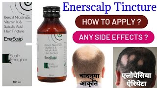 ENERSCALP TINCTURE  Uses  How To Apply  Alternative Brand  Side Effects [upl. by Hulda]