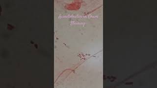 Gram negative bacteria in Gram Staining [upl. by Bolton]