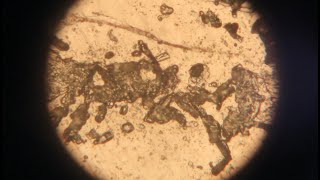 Metallographic microscope observation of intergranular corrosion test of gold phase [upl. by Theo677]