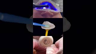 Why Dental Ceramic is the Future of Dentistry [upl. by Mcfarland280]