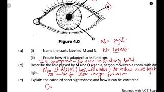 Biology  The eye exam question THE DIGITAL TUTOR [upl. by Bedad]