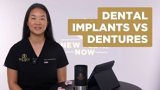 Dental Implants vs Dentures [upl. by Corri]