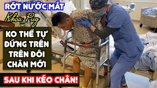 Khoa Pug Rớt Nước Mắt Ko Thể Tự Đứng Trên Đôi Chân Mới Sau Khi Kéo Chân  Một Bước Đi Vạn Dặm Đau [upl. by Koval307]