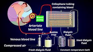 How a Dialysis Machine Works  Dialysis  ARTIFICIAL KIDNEYS [upl. by Ab838]