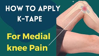 How to treat Knee Pain  Medial Collateral Ligament MCL  Kinesiology taping [upl. by Htidra]