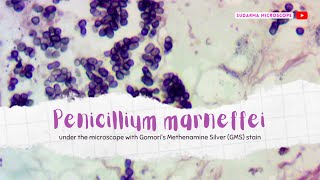 Penicillium marneffei under the microscope with Gomoris Methenamine Silver GMS stain [upl. by Leonteen793]