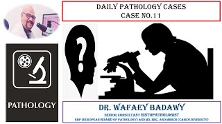 DIALY PATHOLOGY CASES CASE NO 11 Dr Wafaey Badawy [upl. by Xuerd]