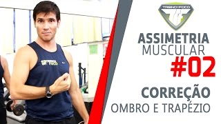 ASSIMETRIA MUSCULAR 2  Como corrigir assimetria de Ombro e Trapézio [upl. by Denny]