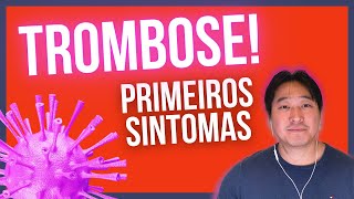 Trombose Os primeiros sintomas da trombose [upl. by Nosnorb591]