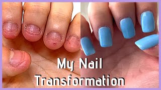 UPDATE My FAST Nail Transformation in 2020 nail journey part 5 [upl. by Eilsek967]