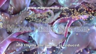 Oncological Hyperthermia treatment Magna Clinic Marbella [upl. by Hoban295]