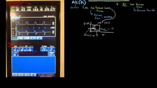 Principles of Mechanical Ventilation 11 Modes  Pressure control [upl. by Iliak]