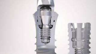 Straumann Dental Implant System [upl. by Irish]