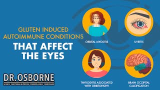 Gluten induced autoimmune diseases that affect the eyes [upl. by Nilak]