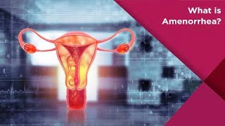 Amenorrhea Absence of Menses  Causes  symptoms amp treatment  Medical Mind [upl. by Yttocs]