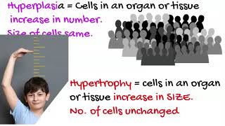 Hyperplasia vs Hypertrophy [upl. by Lau]