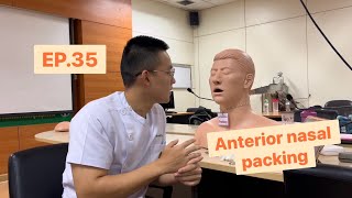 EP 35  Anterior nasal packing การใช้วัสดุกดห้ามเลือดในโพรงจมูกด้านหน้า [upl. by Evante]