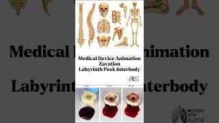 Medical Device Animation  Zavation  Labyrinth Peek Interbody medical animation 3d short [upl. by Redfield]