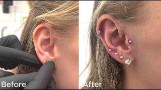 Jonys Vlog 017 FULL Ear Makeover for her wedding [upl. by Ynoffit862]