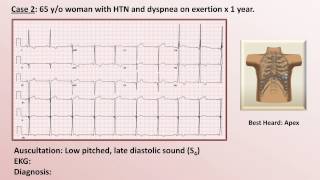 EKG and Heart Murmur Review  Part 1 [upl. by Siddra963]