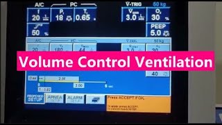 12 Modes of Ventilation Volume Control Mode [upl. by Hiltner]