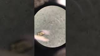 Giardia in a fecal float  Veterinary Video [upl. by Kariotta]