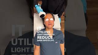 IPL Treatment  Quick and Easy ipl shorts viral [upl. by Neleh]