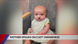 Kokomo mom speaks on Cleft awareness [upl. by Aneele]