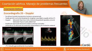 Coartación aórtica Manejo de problemas frecuentes [upl. by Delia]