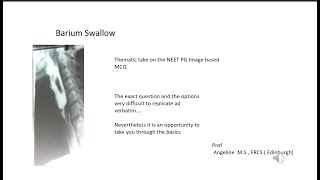 Barium Swallow NEET PG Recall [upl. by Arratoon947]