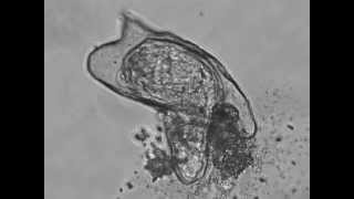 Hatching of a Schistosoma Mansoni Miracidium [upl. by Nyleda]