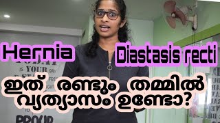 ഇവ തമ്മിൽ വ്യത്യാസം ഉണ്ടോ  Difference Between Diastasis Recti And Hernia [upl. by Kurys]