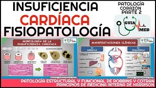 INSUFICIENCIA CARDÍACA FISIOPATOLOGÍA  GuiaMed [upl. by Antipus106]