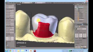 Blender DentalSingle Unitstart to finish [upl. by Asilegna]