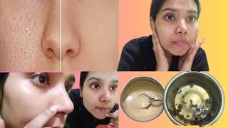 Skin Care For Large Pores And Blackheads 👆 [upl. by Gorski]