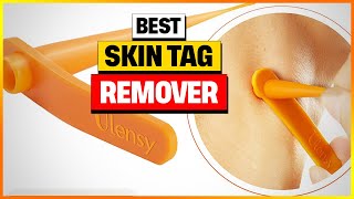 Say Goodbye to Skin Tags with Our TopRated Remover Pen  Skin Tag Remover Pen [upl. by Fia513]