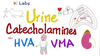 Catecholamines Epinephrine NoEpinephrine Dopamine Metanephrines HVA VMA  Pheochromocytoma [upl. by Seyler]