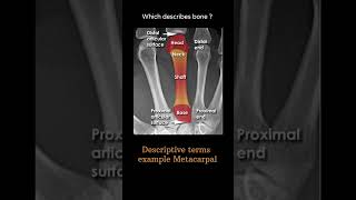 Descriptive terms example  Metacarpal Musculoskeletal Xray Quiz anatomy radiologychannel007 [upl. by Carlye]