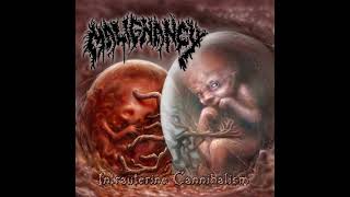 Malignancy  Intrauterine Cannibalism ReRecorded Full Album [upl. by Akselav947]