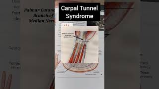 Carpal Tunnel Syndrome [upl. by Lednam823]