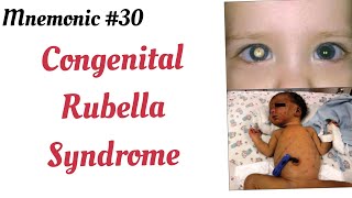 Congenital Rubella Syndrome triad Mnemonic [upl. by Yldarb]