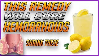 How to Get Rid of Hemorrhoids Fast and Naturally  BEST REMEDY  How to Heal and Cure Hemorrhoids [upl. by Ahsotan]