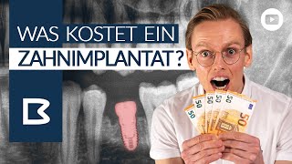 ZahnIMPLANTAT KOSTEN Was muss ICH zahlen Was zahlt die Krankenkasse Alles GENAU erklärt [upl. by Hsuk]