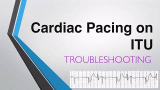 Troubleshooting Transvenous Pacing  Cardiac Pacing on ITU [upl. by Herries]