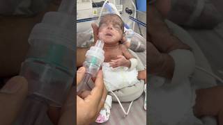 Extubation premature baby part4♥️good reflexes [upl. by Tarrsus773]