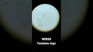 MEIOSIS  Pachytene Stage [upl. by Nennahs]