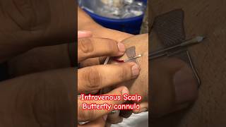 Butterfly cannulation  cannula cannulation trending ivtherapy SMpharmacy plz subscribe [upl. by Aihsal]