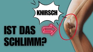 Knirschen im Knie Solltest du dir Sorgen machen [upl. by Adamina]